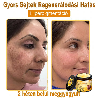 💝𝐕𝐋𝐒𝑽𝑳𝑺® 𝐌é𝐡𝐦é𝐫𝐞𝐠 𝐁ő𝐫 𝐇𝐞𝐥𝐲𝐫𝐞á𝐥𝐥í𝐭ó 𝐊𝐫é𝐦 (👨‍⚕‍CE Tanúsítvány)✅💟🏡✨ Magyarországon készült és innen szállítjuk 🌟