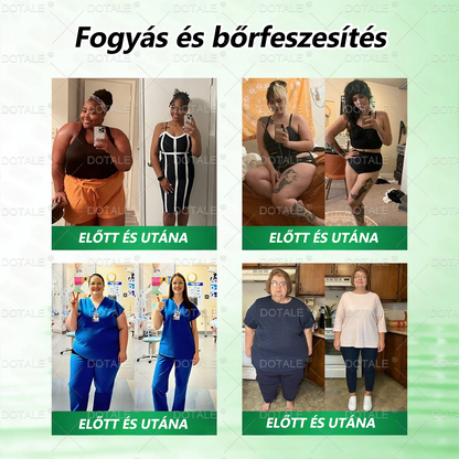 🔥 Extra 30% kedvezmény + ingyenes gyors szállítás!💚 Akár 12–25 kg fogyás 4–8 hét alatt – természetes, biztonságos és klinikailag tesztelt!✅ 180 napos pénzvisszafizetési garancia – kockázat nélkül!