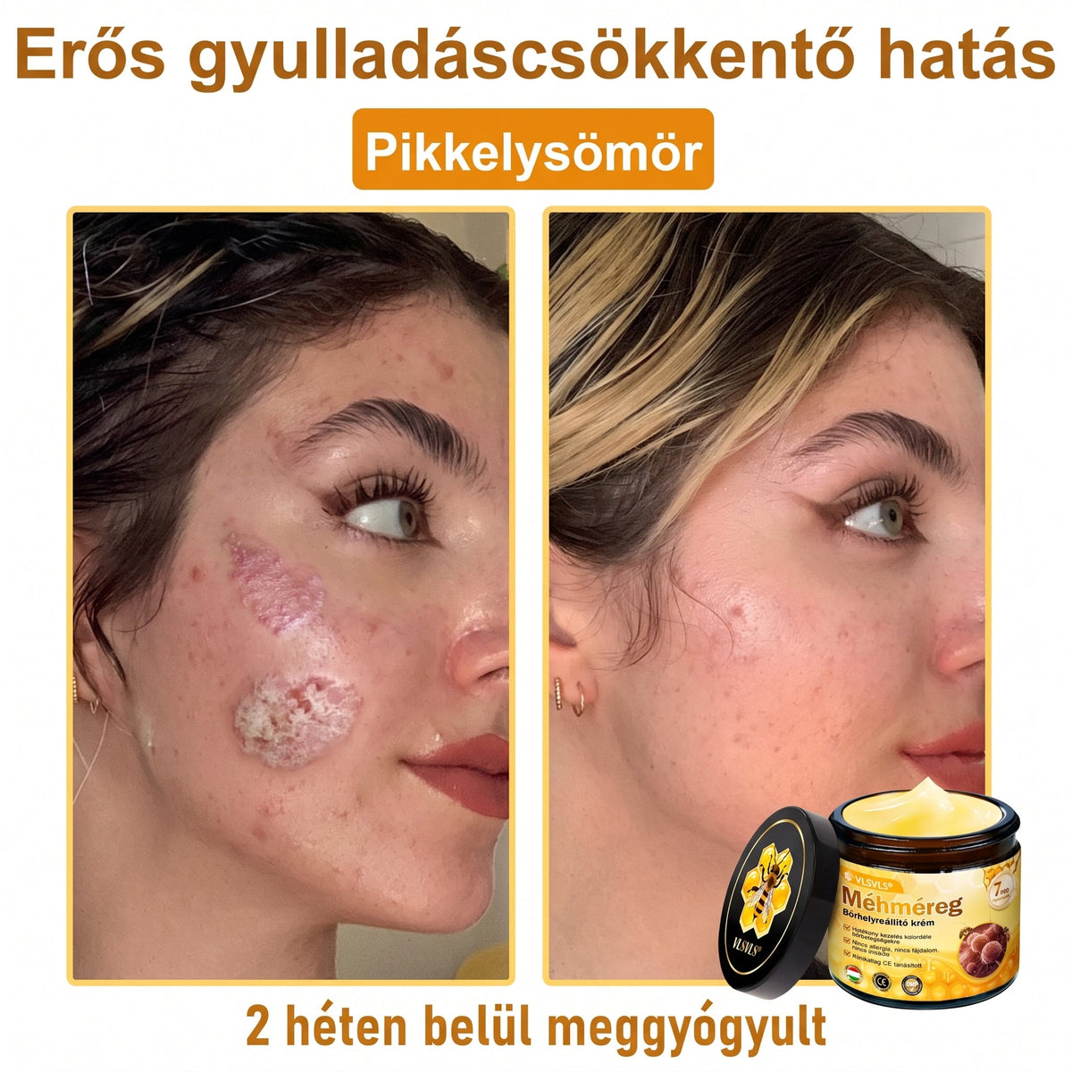 💝𝐕𝐋𝐒𝑽𝑳𝑺® 𝐌é𝐡𝐦é𝐫𝐞𝐠 𝐁ő𝐫 𝐇𝐞𝐥𝐲𝐫𝐞á𝐥𝐥í𝐭ó 𝐊𝐫é𝐦 (👨‍⚕‍CE Tanúsítvány)✅💟🏡✨ Magyarországon készült és innen szállítjuk 🌟