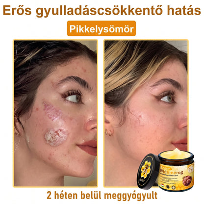 💝𝐕𝐋𝐒𝑽𝑳𝑺® 𝐌é𝐡𝐦é𝐫𝐞𝐠 𝐁ő𝐫 𝐇𝐞𝐥𝐲𝐫𝐞á𝐥𝐥í𝐭ó 𝐊𝐫é𝐦 (👨‍⚕‍CE Tanúsítvány)✅💟🏡✨ Magyarországon készült és innen szállítjuk 🌟