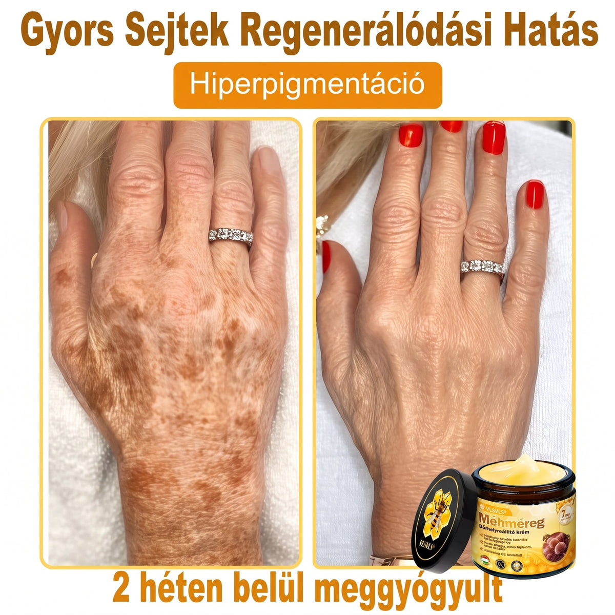 💝𝐕𝐋𝐒𝑽𝑳𝑺® 𝐌é𝐡𝐦é𝐫𝐞𝐠 𝐁ő𝐫 𝐇𝐞𝐥𝐲𝐫𝐞á𝐥𝐥í𝐭ó 𝐊𝐫é𝐦 (👨‍⚕‍CE Tanúsítvány)✅💟🏡✨ Magyarországon készült és innen szállítjuk 🌟