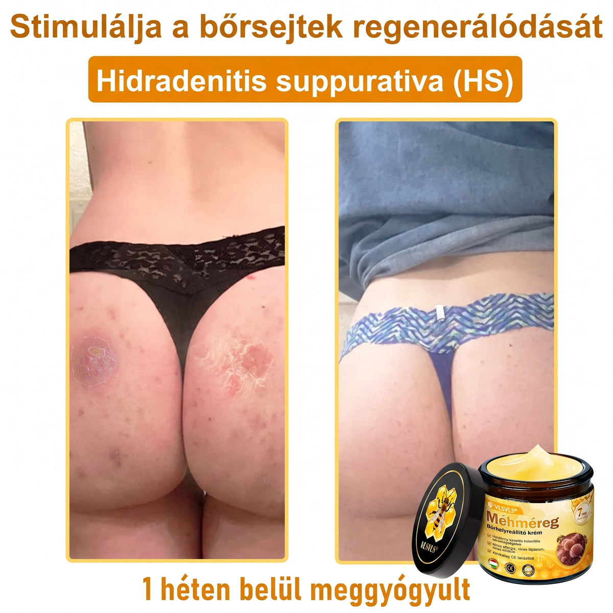 💝𝐕𝐋𝐒𝑽𝑳𝑺® 𝐌é𝐡𝐦é𝐫𝐞𝐠 𝐁ő𝐫 𝐇𝐞𝐥𝐲𝐫𝐞á𝐥𝐥í𝐭ó 𝐊𝐫é𝐦 (👨‍⚕‍CE Tanúsítvány)✅💟🏡✨ Magyarországon készült és innen szállítjuk 🌟