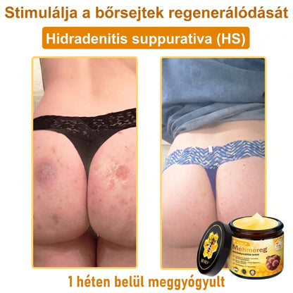 💝𝐕𝐋𝐒𝑽𝑳𝑺® 𝐌é𝐡𝐦é𝐫𝐞𝐠 𝐁ő𝐫 𝐇𝐞𝐥𝐲𝐫𝐞á𝐥𝐥í𝐭ó 𝐊𝐫é𝐦 (👨‍⚕‍CE Tanúsítvány)✅💟🏡✨ Magyarországon készült és innen szállítjuk 🌟