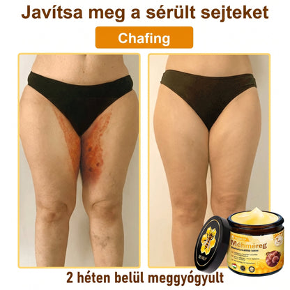 💝𝐕𝐋𝐒𝑽𝑳𝑺® 𝐌é𝐡𝐦é𝐫𝐞𝐠 𝐁ő𝐫 𝐇𝐞𝐥𝐲𝐫𝐞á𝐥𝐥í𝐭ó 𝐊𝐫é𝐦 (👨‍⚕‍CE Tanúsítvány)✅💟🏡✨ Magyarországon készült és innen szállítjuk 🌟