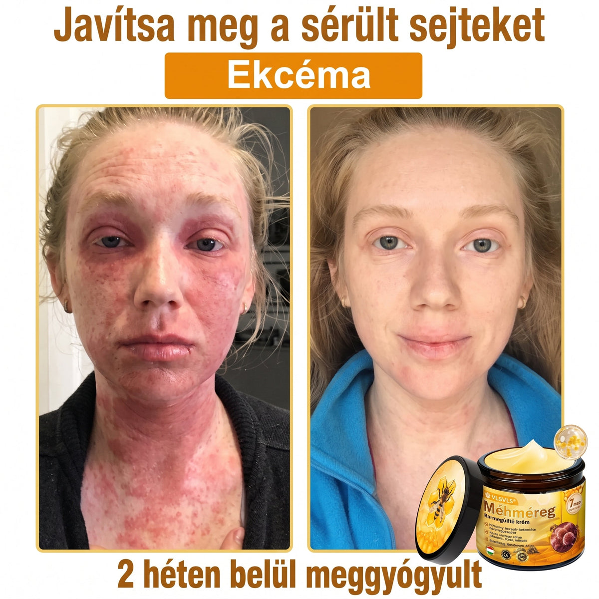 💝𝐕𝐋𝐒𝑽𝑳𝑺® 𝐌é𝐡𝐦é𝐫𝐞𝐠 𝐁ő𝐫 𝐇𝐞𝐥𝐲𝐫𝐞á𝐥𝐥í𝐭ó 𝐊𝐫é𝐦 (👨‍⚕‍CE Tanúsítvány)✅💟🏡✨ Magyarországon készült és innen szállítjuk 🌟